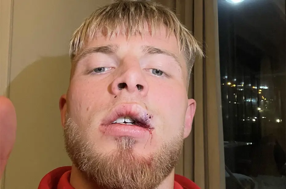 Samsunspor'dan Galatasaray maçı sonrası bir açıklama daha - 5