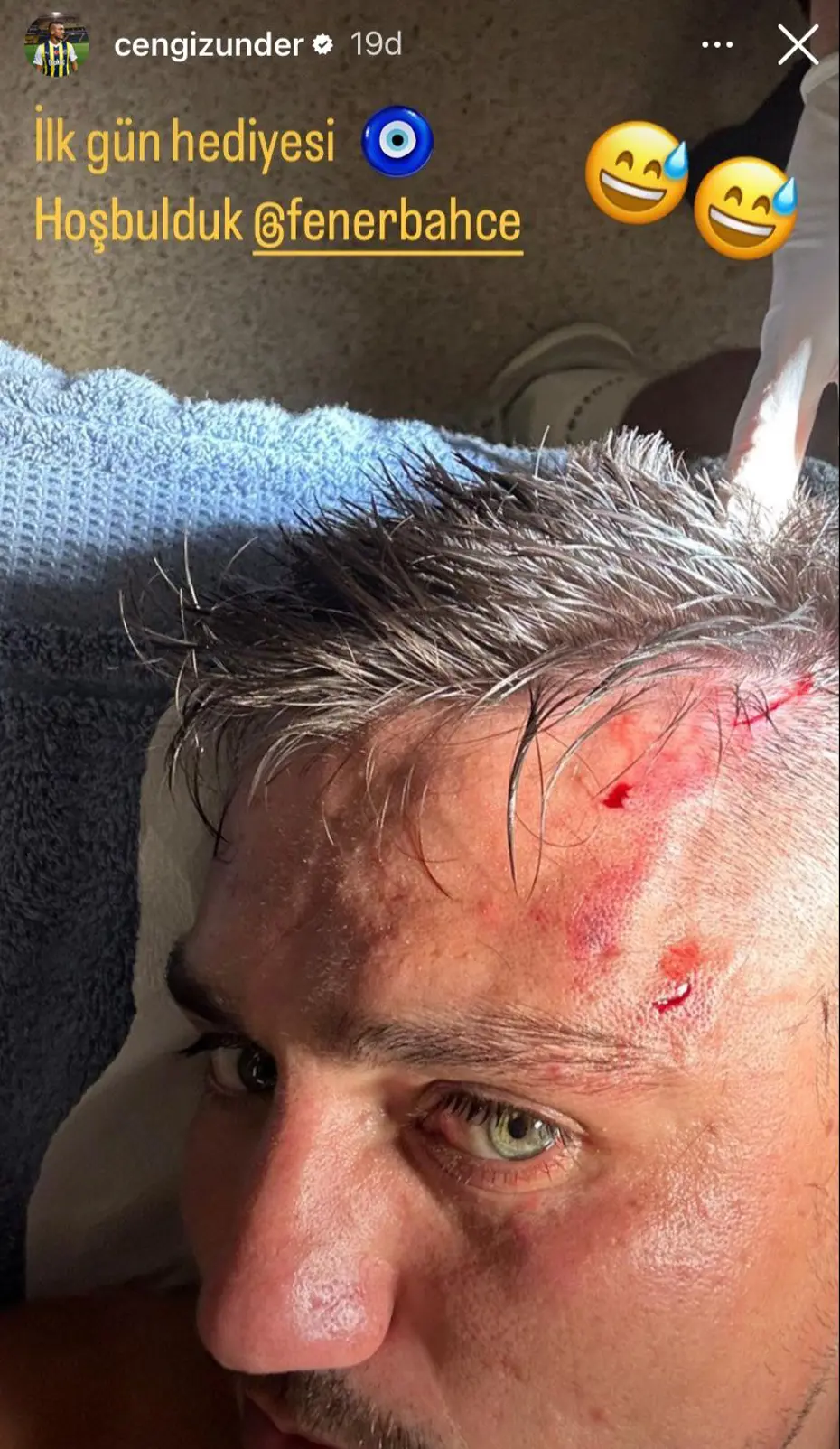 Fenerbahçe'de Cengiz Ünder'den talihsiz başlangıç - 5