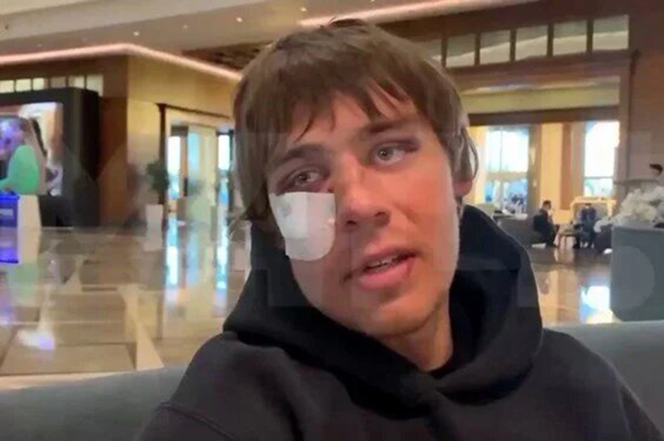 Rus ve Ukraynalı futbolcular Antalya'da tekme tokat kavga etti