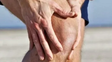 Ön çapraz bağ kopması nedir? Çapraz bağ kopması belirtileri neler, nasıl tedavi edilir?