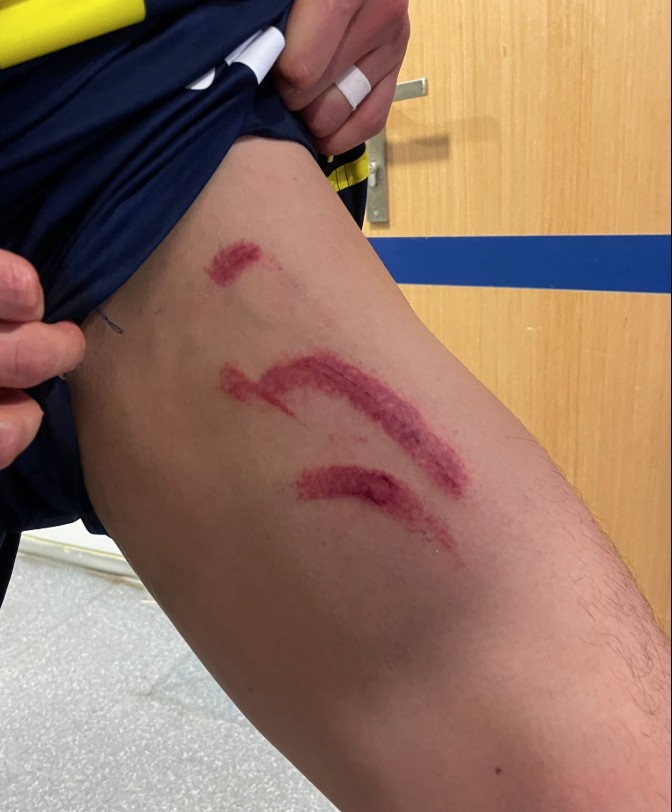 Edson Alvarez'den Stuttgart maçı biter bitmez sakatlık açıklaması geldi: Bacağının son hali korkutmuştu - 2