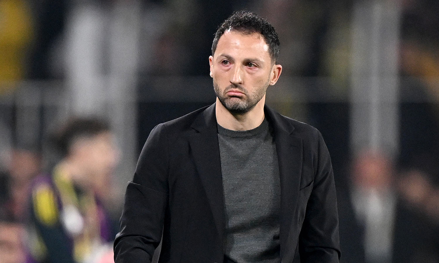 Domenico Tedesco Kayserispor maçı öncesi hücum planını çizdi: 