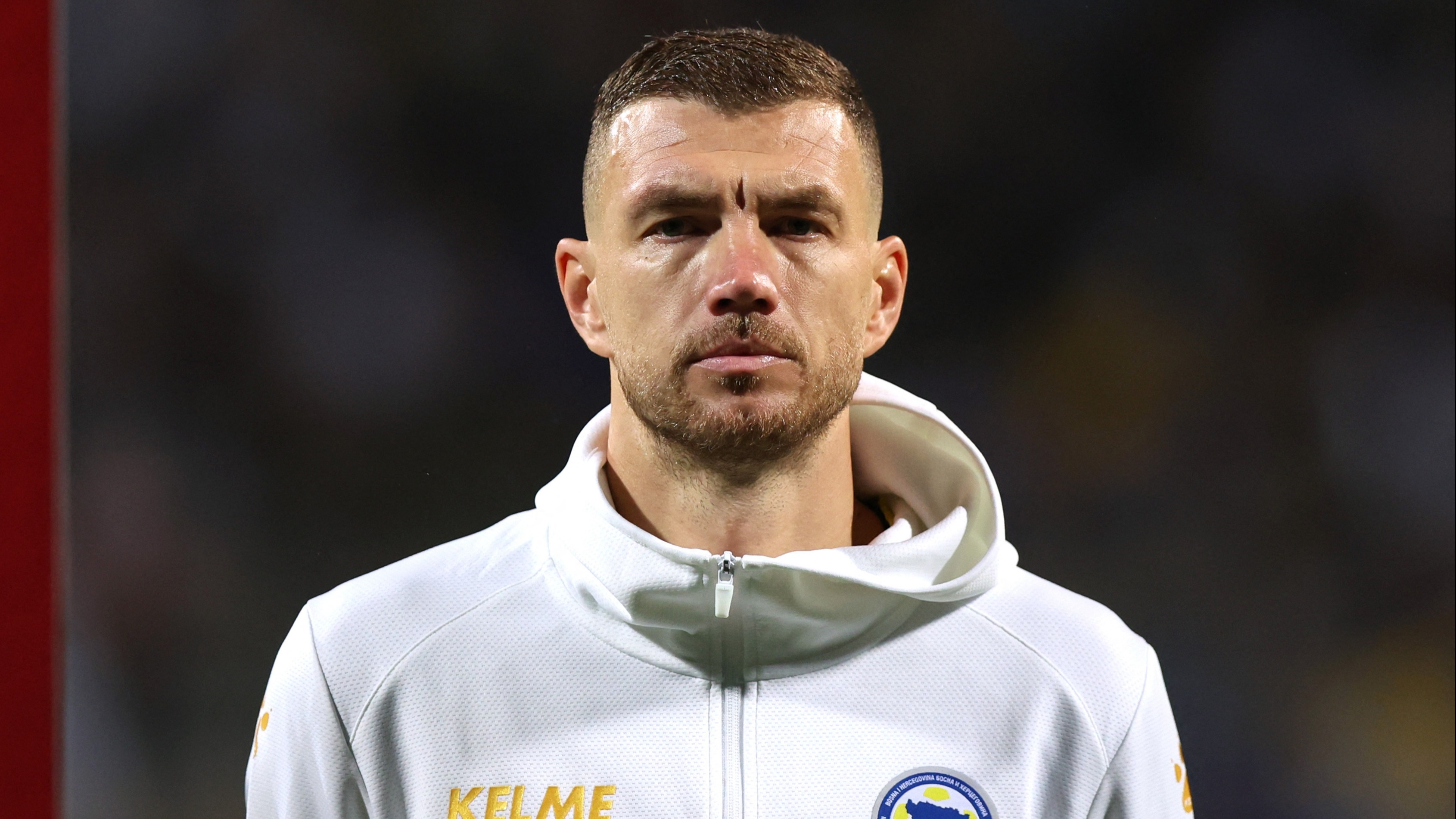 Dünya Dzeko'nun dünkü maçta geldiği hali konuşuyor