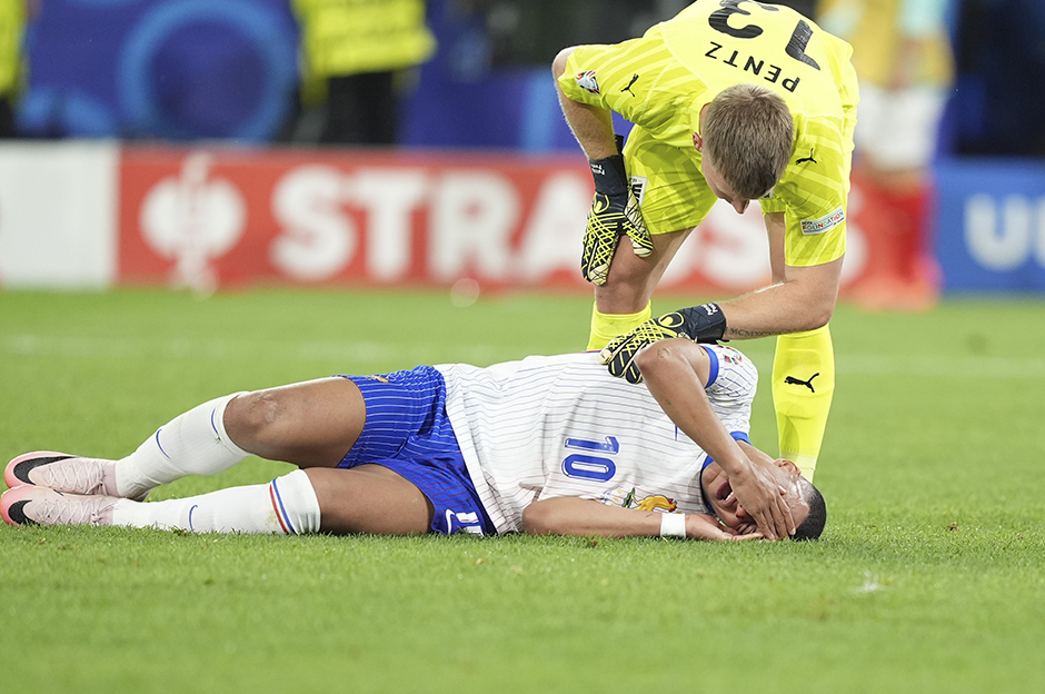 Burnu kırılan Mbappe'nin son durumu belli oldu: Kalan maçlarda forma giyebilecek mi?