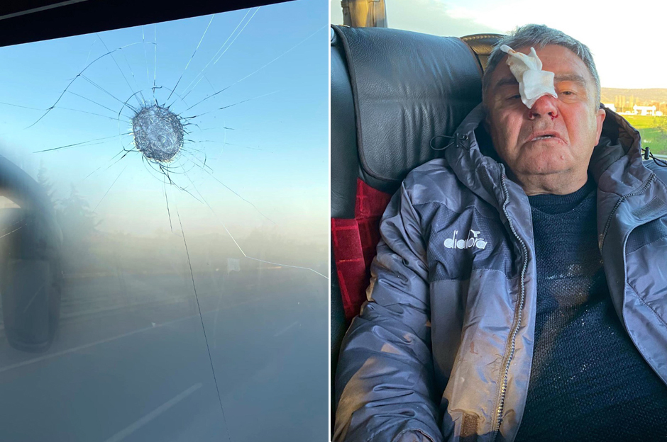 Deplasman dönüşü takım otobüsüne saldırı: Sportif direktörün burnu kırıldı