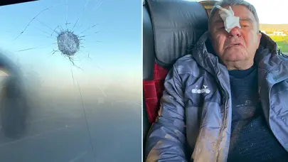 Deplasman dönüşü takım otobüsüne saldırı: Sportif direktörün burnu kırıldı