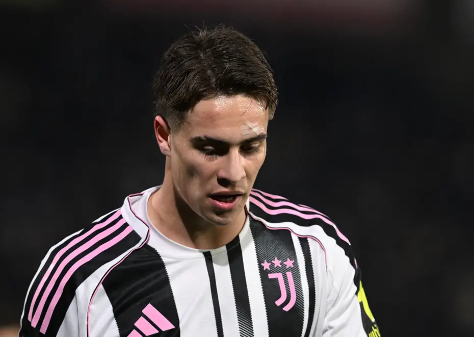 Juventus’un dokunulmazı Kenan Yıldız