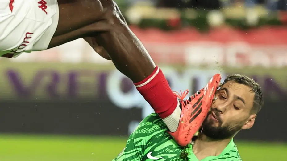 Ve Galatasaray anlaşma sağladı: Donnarumma'nın yüzünü paramparça etmiş, dünya onu konuşmuştu - 4